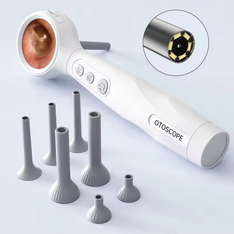 Otoscopio digital con cámara HD 4X